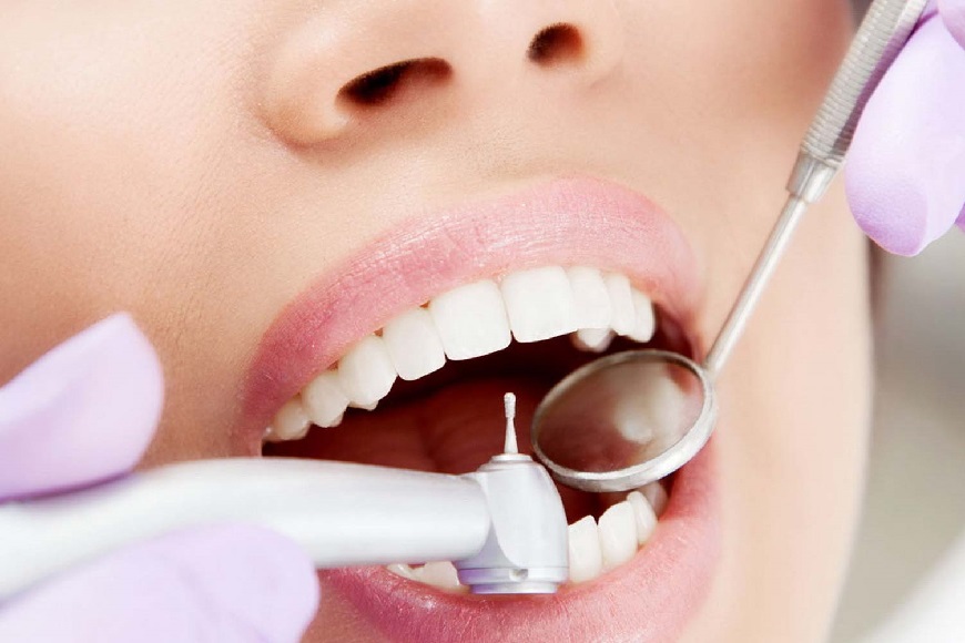 Odontoiatria conservativa